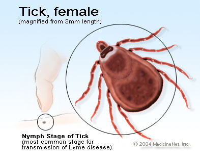 Picture of a deer tick