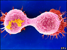 Breast cancer cells